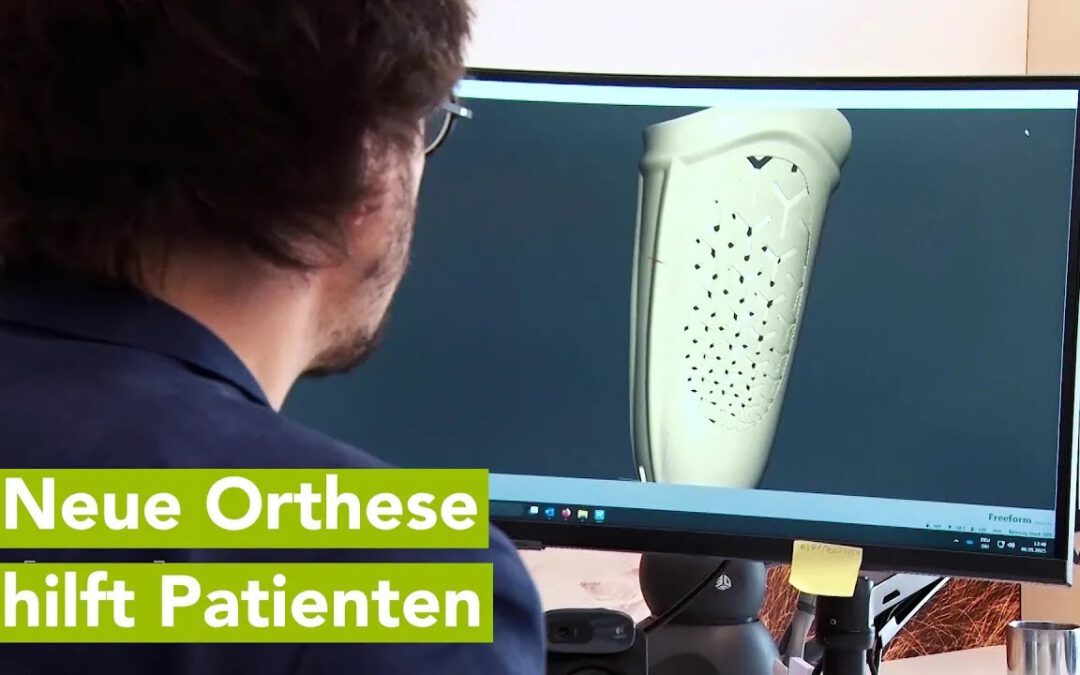 Wirtschaftsfenster MV: Rostocker Orthopädie-Firma entwickelt Orthese für diabetisches Fußsyndrom